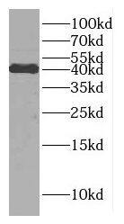 DNAJB11 Antibody - BSA Free