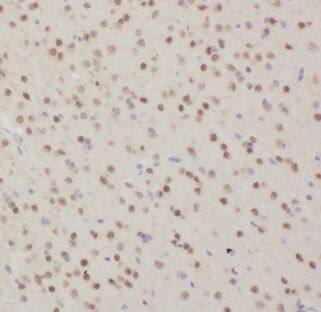 Dynein intermediate chain 2 Antibody - BSA Free