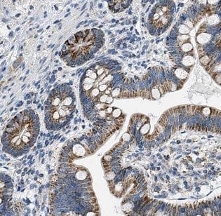 DNAH6 Antibody - BSA Free