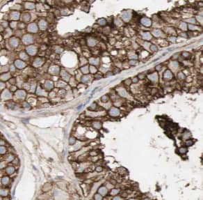 DNAH14 Antibody - BSA Free