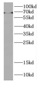 DMRTA1 Antibody - BSA Free
