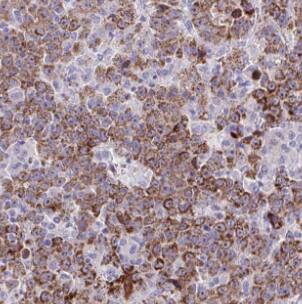 DMGDH Antibody - BSA Free