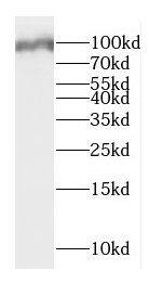 DMGDH Antibody - BSA Free