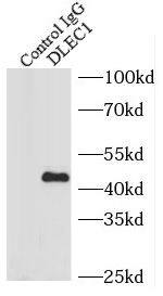 DLC1/DLEC1 Antibody - BSA Free