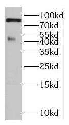DLC1/DLEC1 Antibody - BSA Free