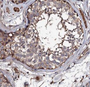 DLC1/DLEC1 Antibody - BSA Free