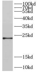 DIRAS2 Antibody - BSA Free