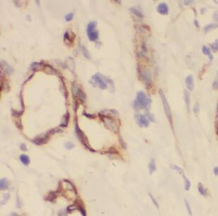 DIRAS1 Antibody - BSA Free