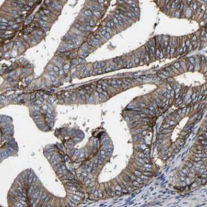 DIO1 Antibody - BSA Free