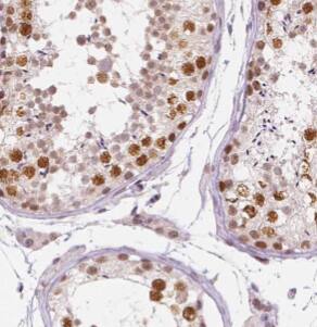 DHX35 Antibody - BSA Free