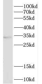 Dehydrodolichyl Diphosphate Synthase Antibody - BSA Free