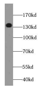 DGKK Antibody - BSA Free