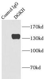 DGKH Antibody - BSA Free