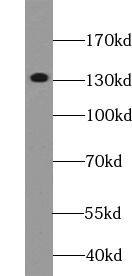 DGKH Antibody - BSA Free