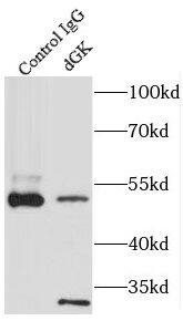 Deoxyguanosine kinase Antibody - BSA Free
