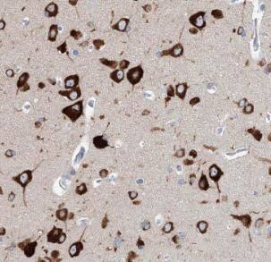 Dfna5 Antibody - BSA Free