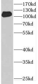 DENND1A Antibody - BSA Free