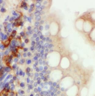 Defensin beta 1 Antibody - BSA Free