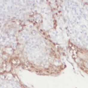 DEF6 Antibody - BSA Free