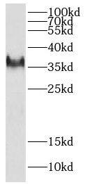 DEDD2 Antibody - BSA Free