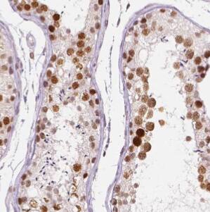 DDX3Y Antibody - BSA Free