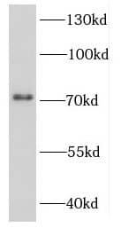 DDX3Y Antibody - BSA Free