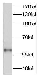 DDX28 Antibody - BSA Free