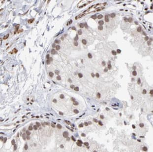 DDX28 Antibody - BSA Free