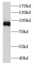 DDX27 Antibody - BSA Free