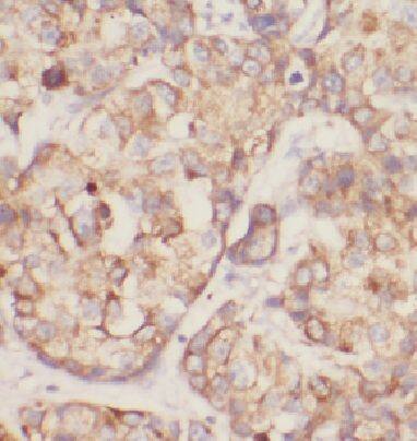 DDRGK1 Antibody - BSA Free