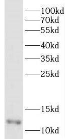 DDA1 Antibody - BSA Free