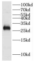 DCUN1D5 Antibody - BSA Free