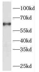 DBR1 Antibody - BSA Free