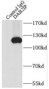 DAB2IP Antibody - BSA Free