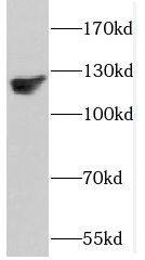 DAAM1 Antibody - BSA Free