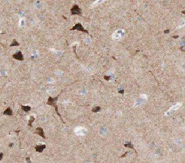 DAAM1 Antibody - BSA Free