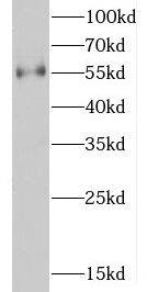 D2HGDH Antibody - BSA Free