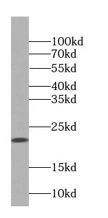 Cysteine Dioxygenase Type 1 Antibody - BSA Free