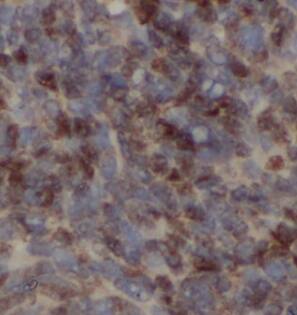 Cysteine Dioxygenase Type 1 Antibody - BSA Free