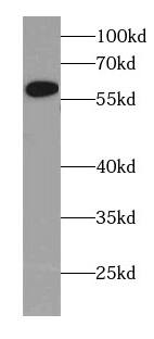 CYP4Z1 Antibody - BSA Free