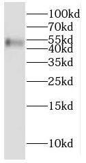 CYP2W1 Antibody - BSA Free
