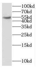 CYP2S1 Antibody - BSA Free