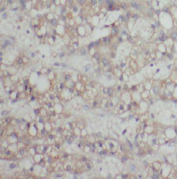 Cytochrome p450 2J2 Antibody - BSA Free