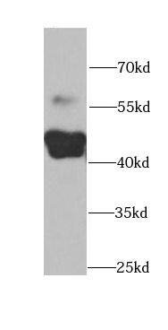 CYP2F1 Antibody - BSA Free