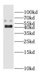 CYP20A1 Antibody - BSA Free