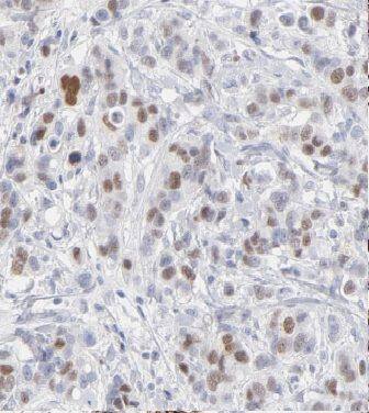 Cyclin G Antibody - BSA Free
