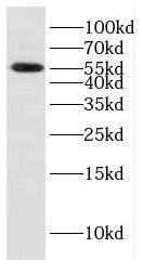 CYB5R4 Antibody - BSA Free