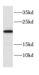 Cytochrome b5 Outer Mitochondrial Membrane Antibody - BSA Free