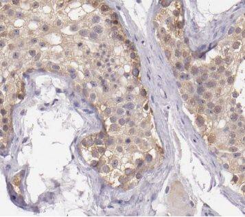 Cytochrome b5 Outer Mitochondrial Membrane Antibody - BSA Free