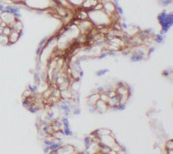 CT83 Antibody - BSA Free